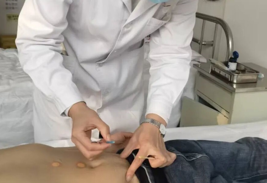 穴位埋线多神奇，针灸理疗告诉你——我院新开展中医特色技术穴位埋线治疗